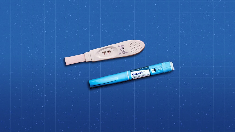 does semaglutide help with pregnancy This is what happens when you stop taking Ozempic