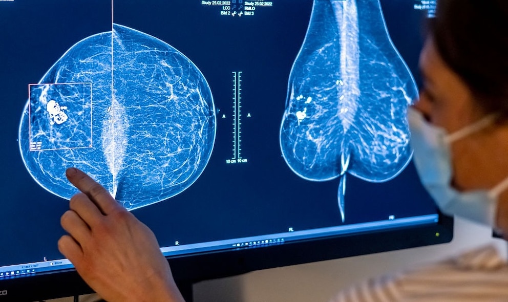 PHOTO: Mammography