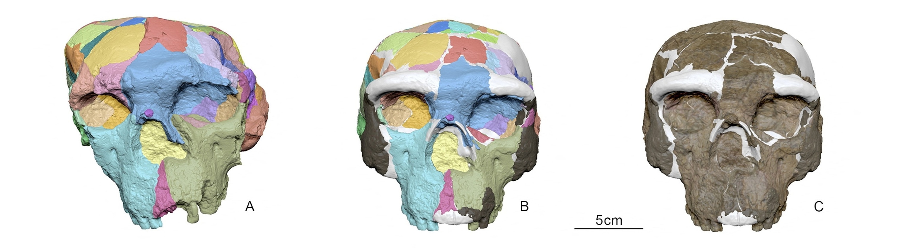 PHOTO: The digital reconstruction process used on an archaic human skull, called Yunxian 2, that was unearthed in 1990 in China's Hubei Province, is shown in this image released on Sept. 25, 2025.