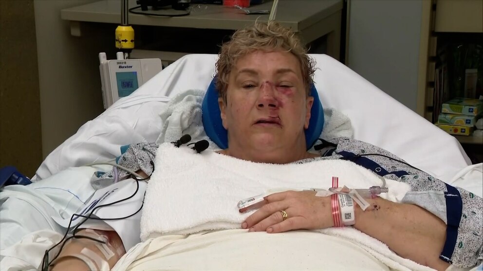 Video Pennsylvania woman recounts bear attack from hospital bed ABC News