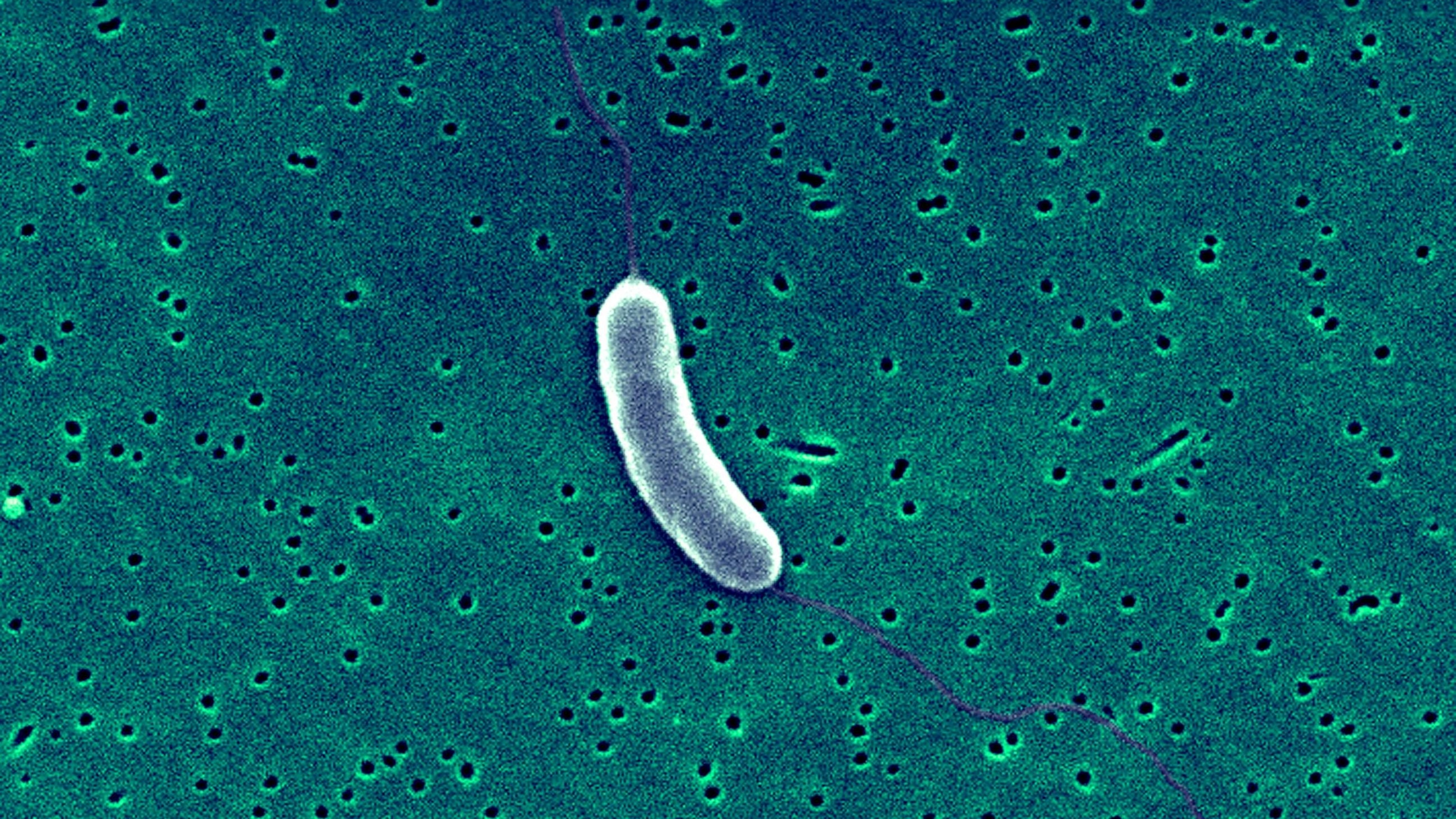 PHOTO: A Vibrio Vulnificus bacterium.