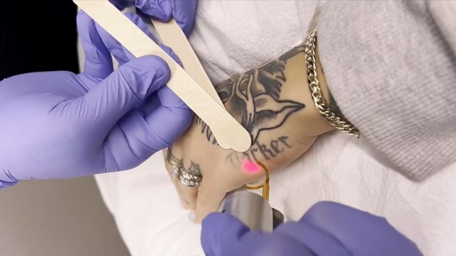 Catalyst Abc Tattoos Revolutionizing Tattoos: From Beauty To
