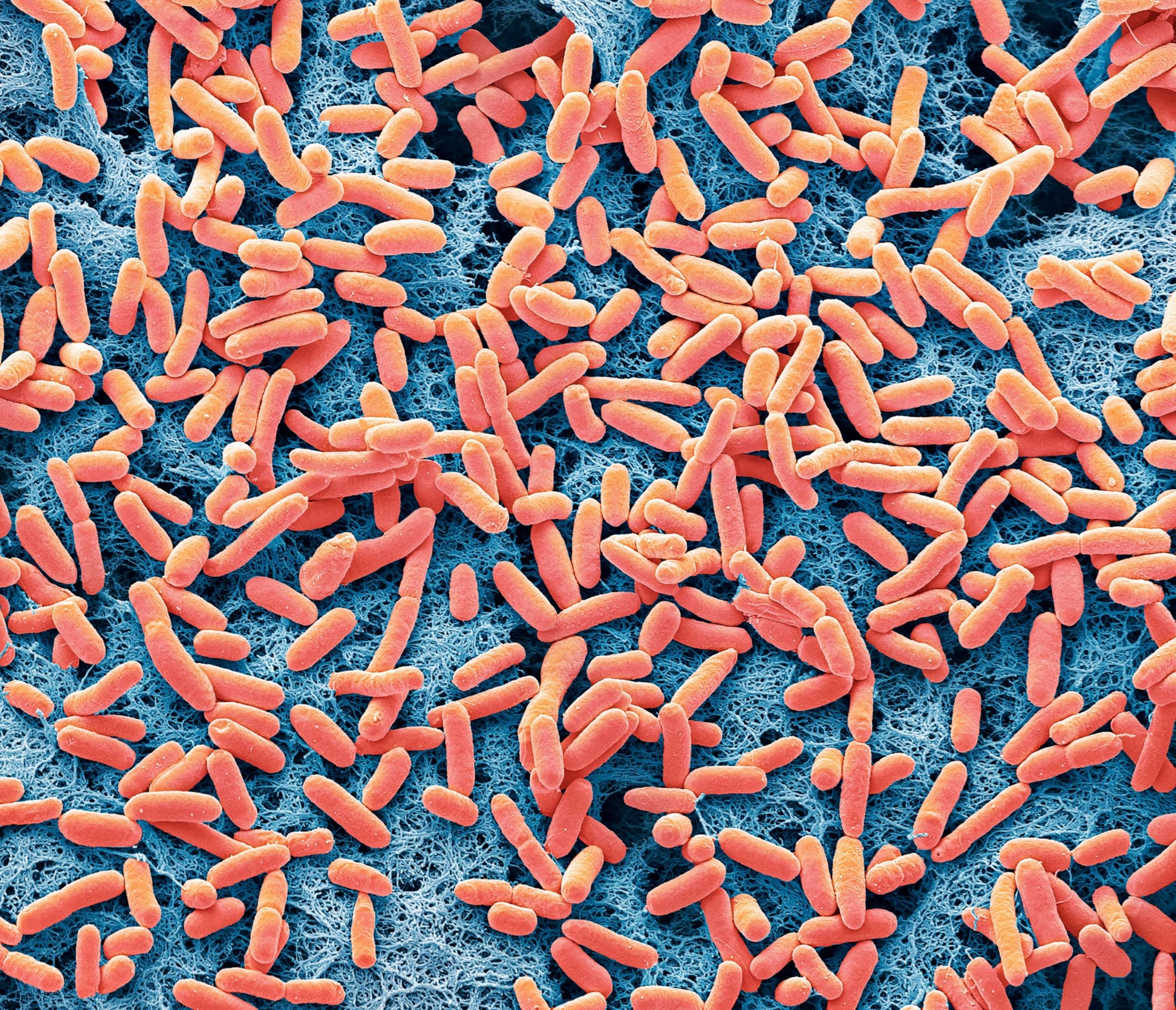 PHOTO: In this undated file photo, a scanning electron micrograph of E.coli bacteria is shown.