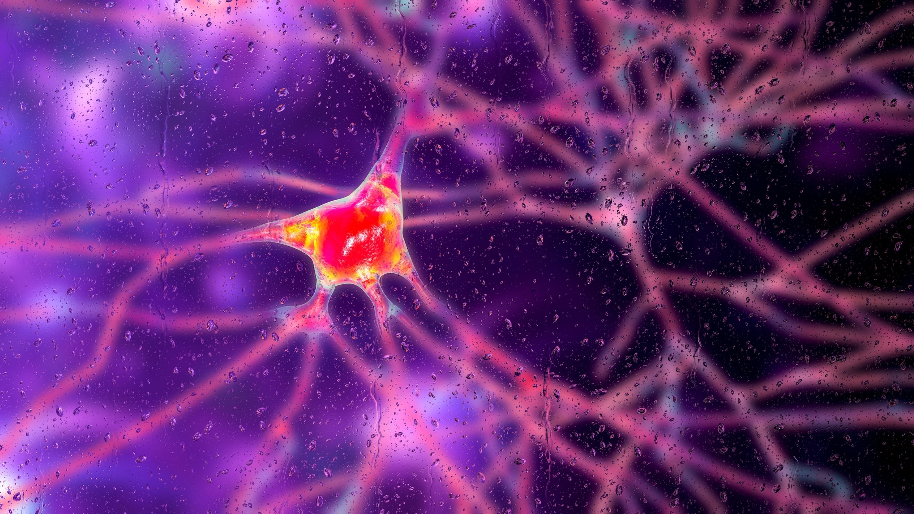PHOTO: Neurons in dementia, conceptual illustration