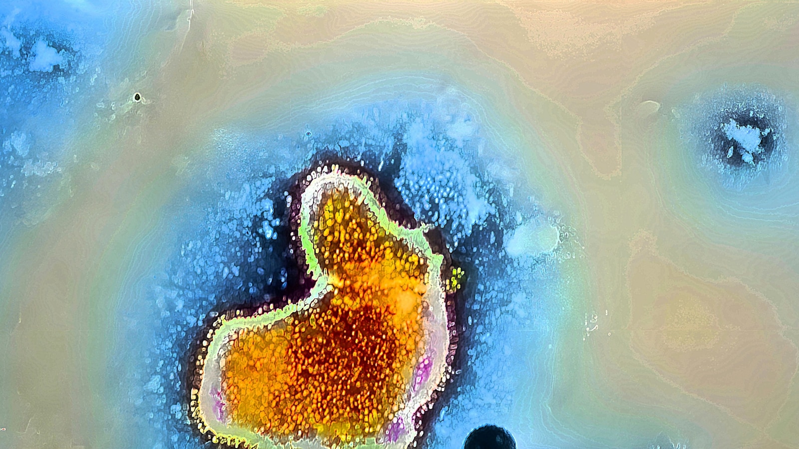 What to know about rare braineating amoeba after Texas woman dies