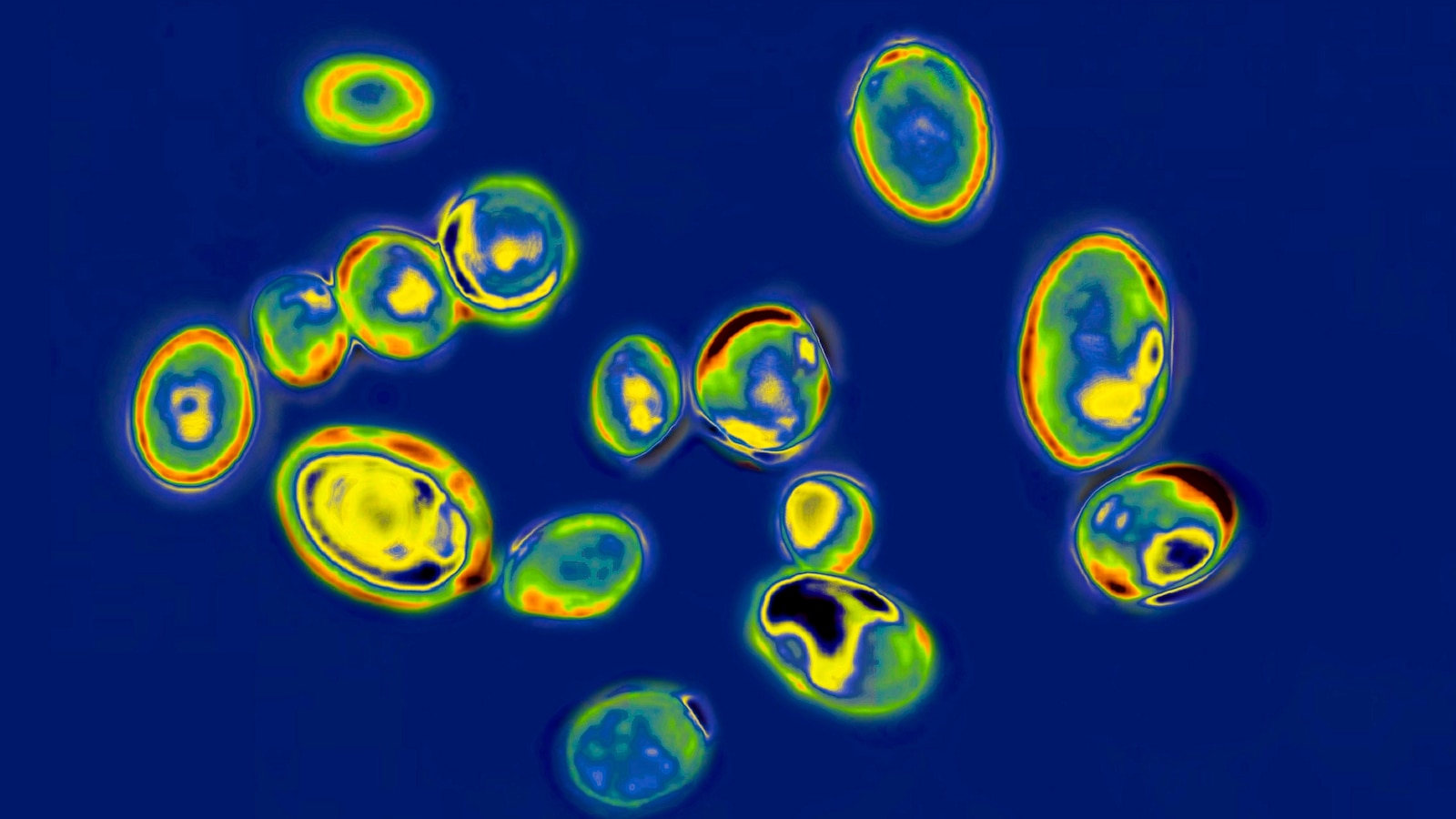 CDC estimates 9.7 million drug-resistant infections and 50,800 US deaths yearly