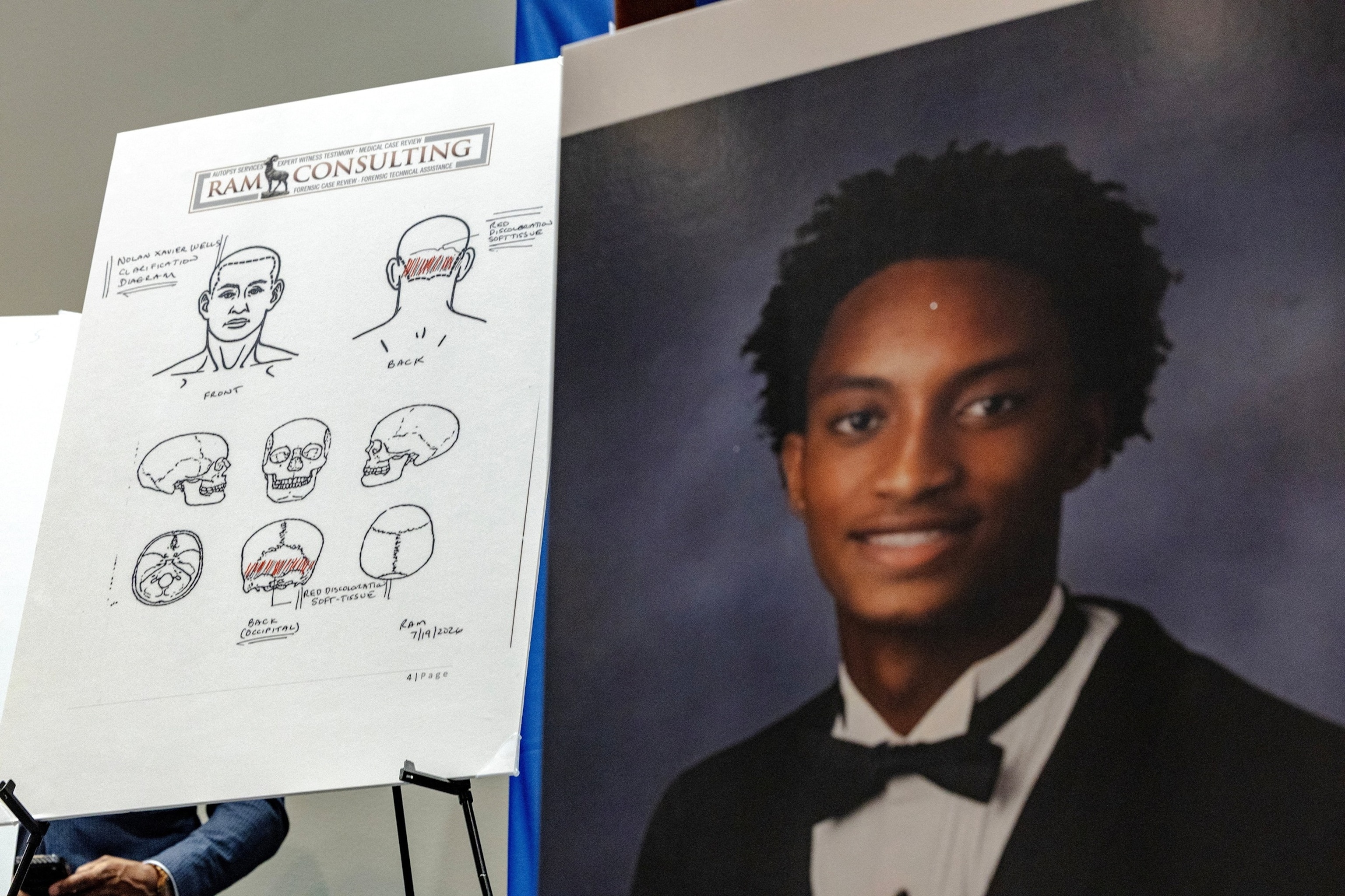 PHOTO: Lawyer announces autopsy results in Nolan Wells case