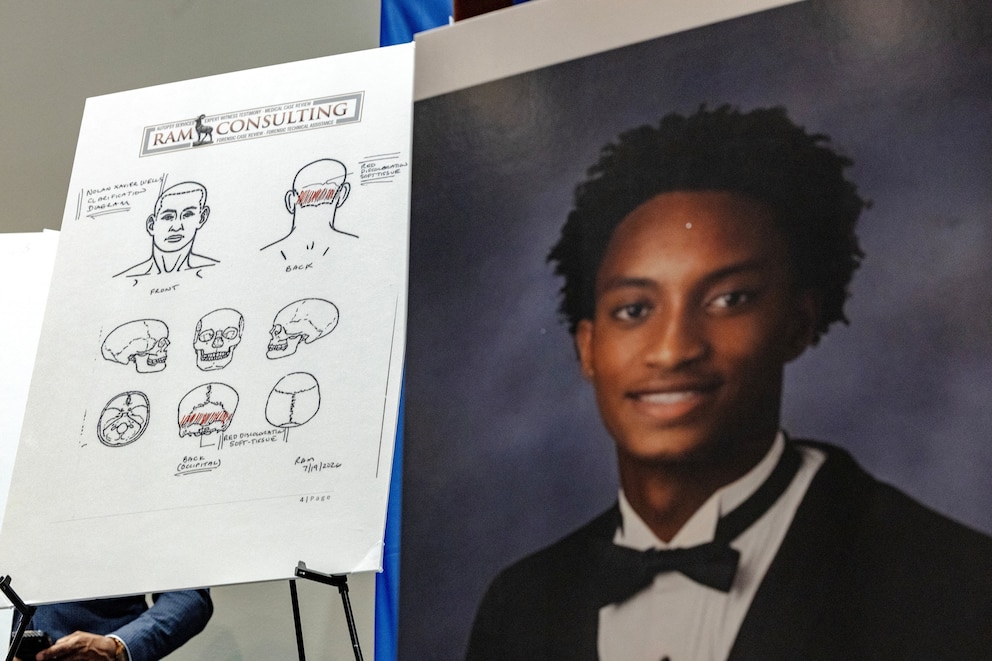 PHOTO: Lawyer announces autopsy results in Nolan Wells case