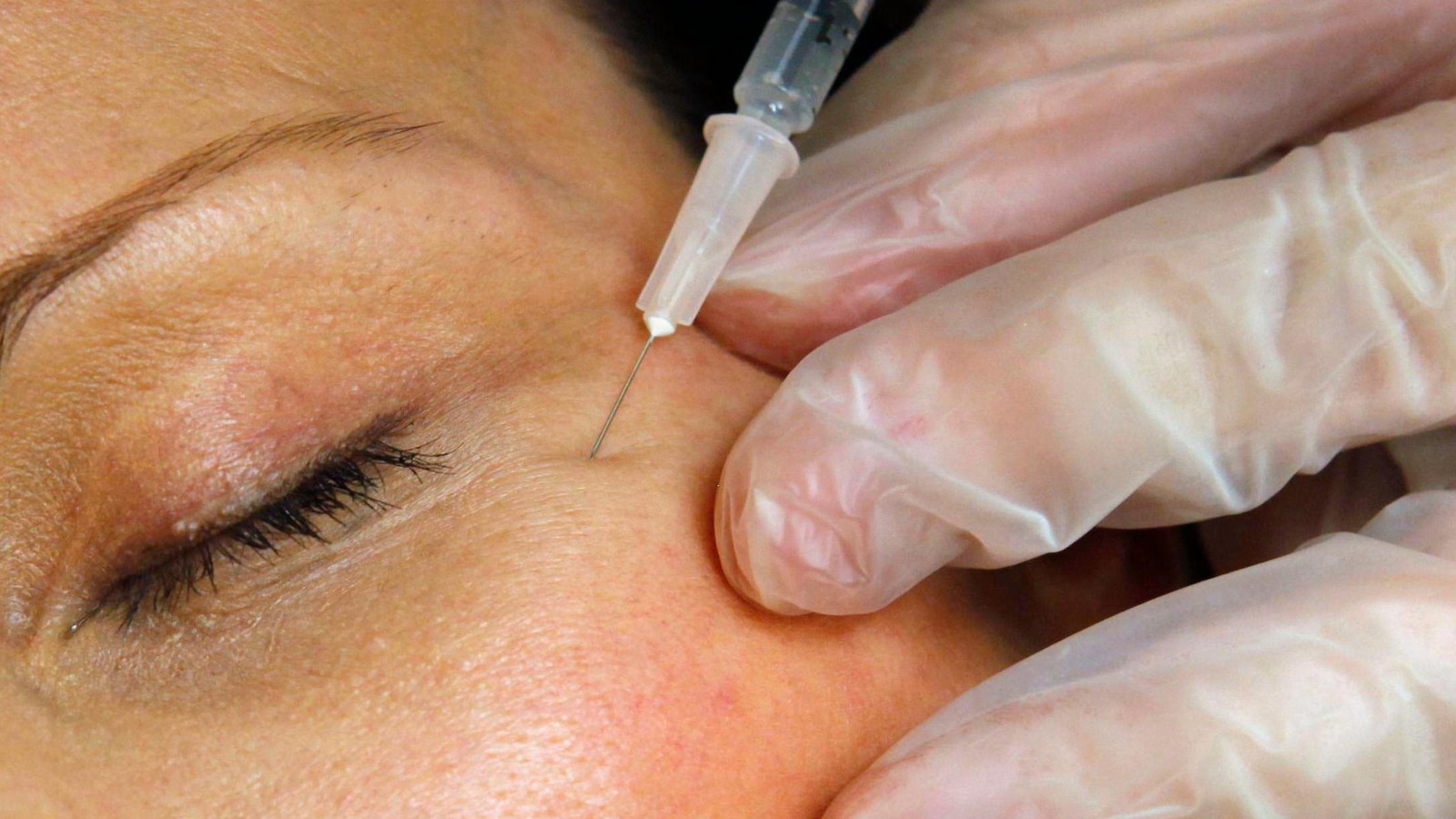 FDA warns websites selling unapproved Botox for cosmetic purposes
