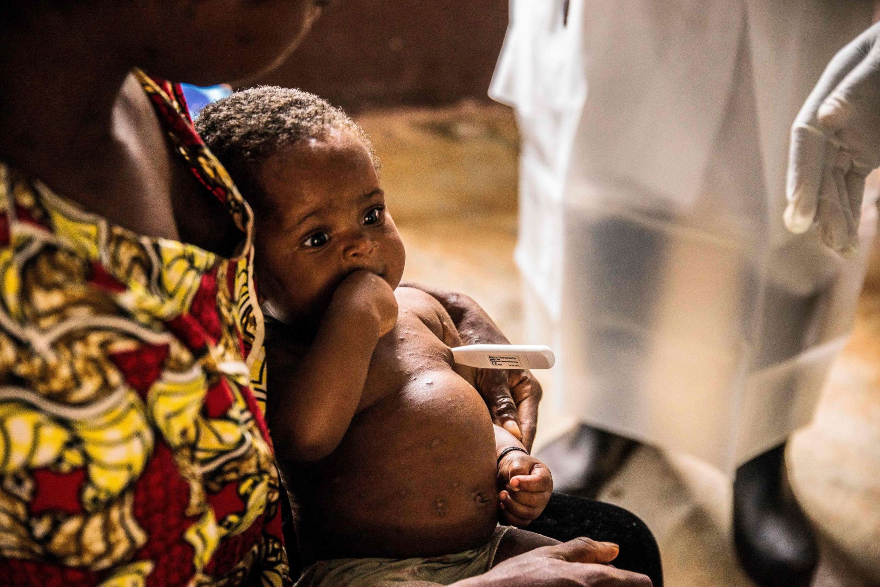 PHOTO: A woman and her child, both infected with monkeypox await treatment at the quarantine of the centre of the International medical NGO Doctors Without BorderS, in Zomea Kaka, in the Central African Republic, on Oct. 18, 2018.  