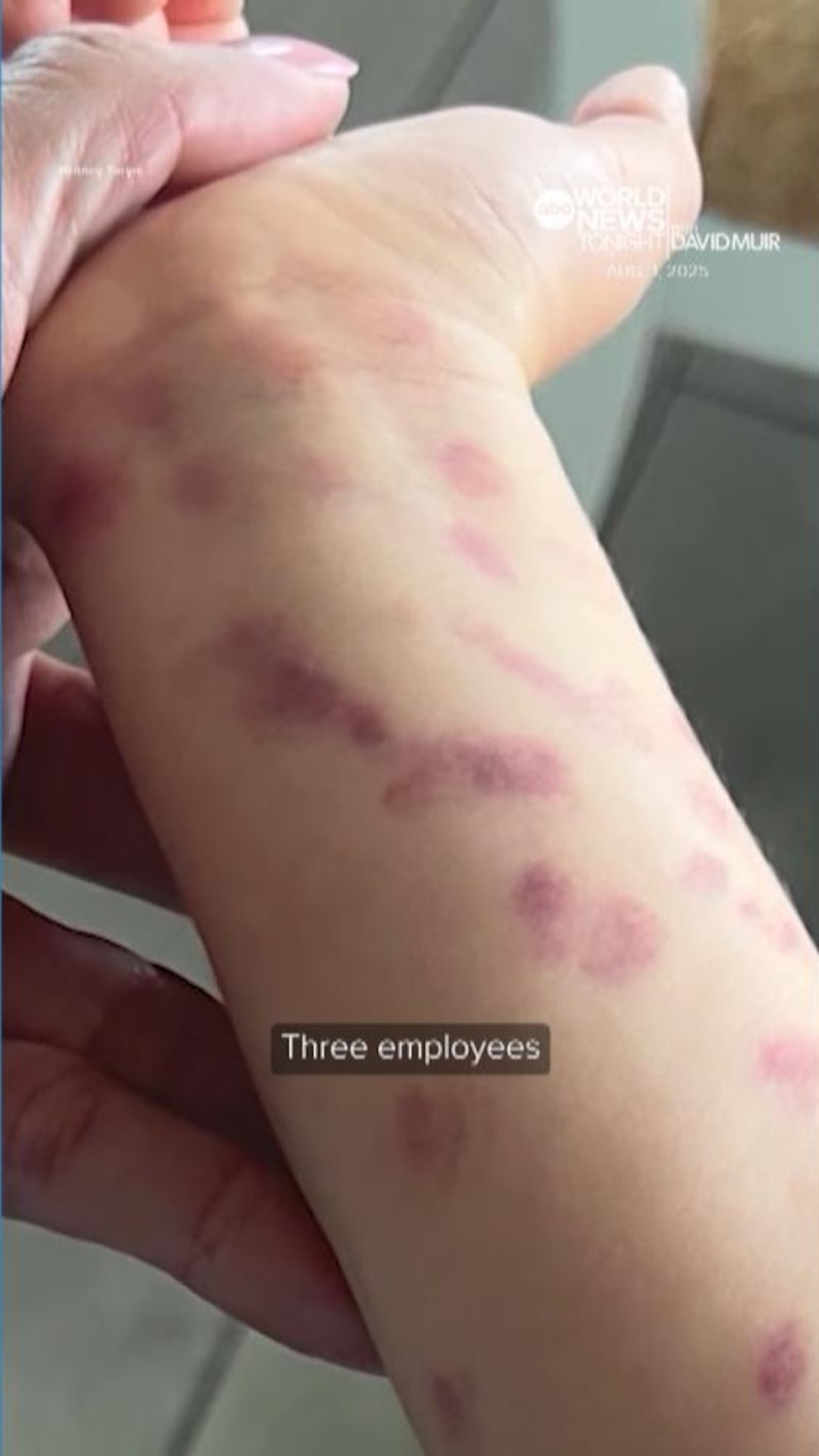 NextImg:Video Texas boy recovering after injury from octopus at San Antonio Aquarium, mother says