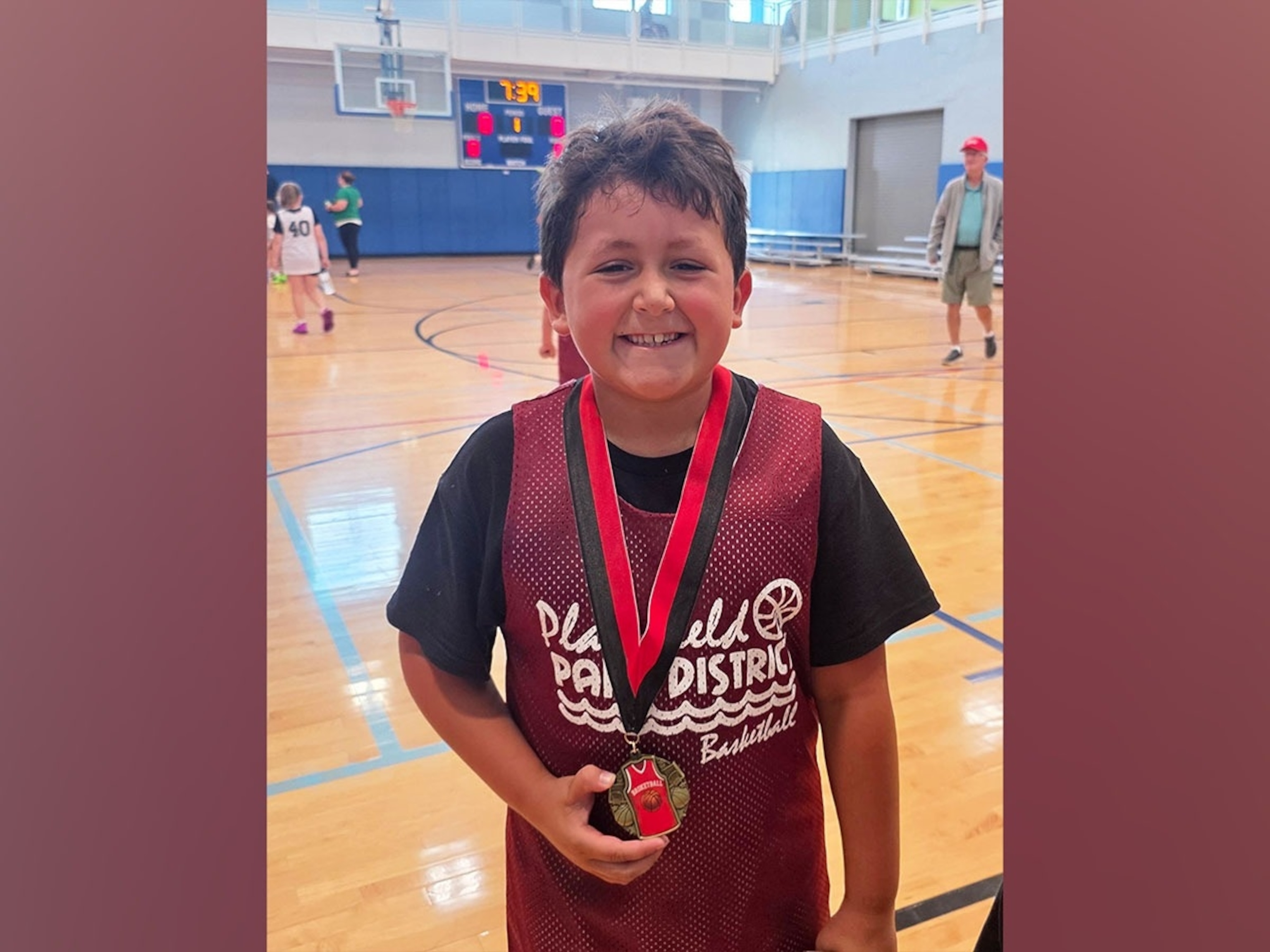 Mom shares warning after 9-year-old son suffers burns after microwaving toy - ABC News