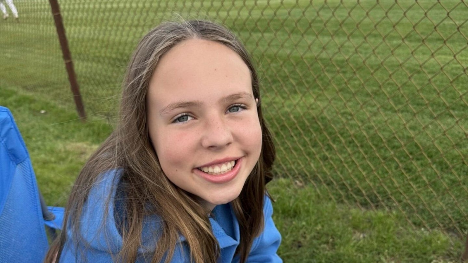 Neurosurgeon's Optimism for Young Victim of Minneapolis Church Shooting