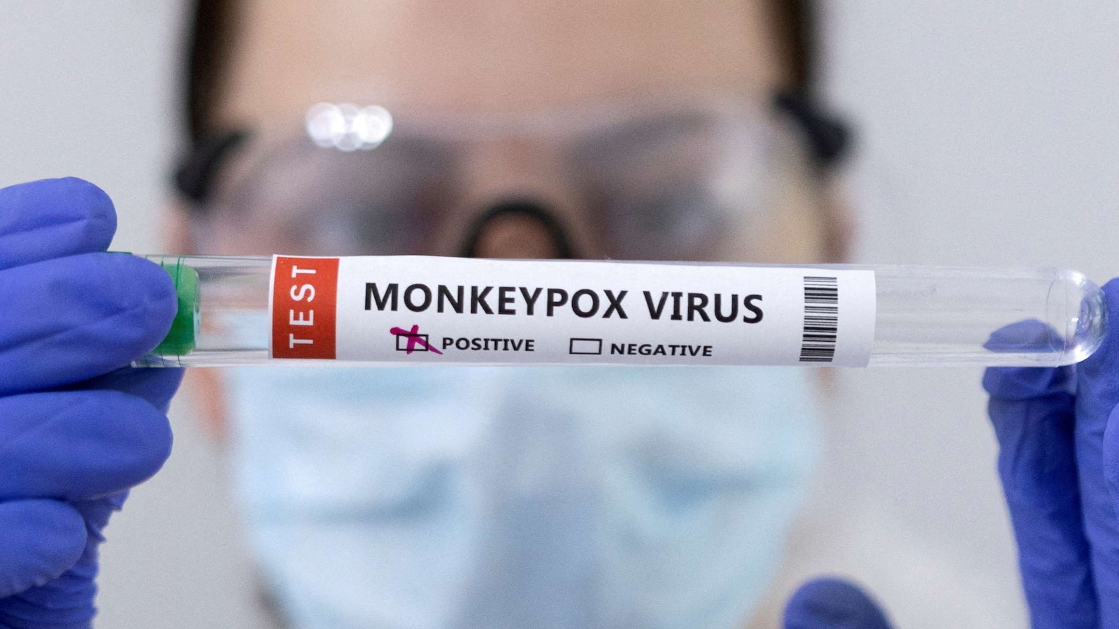 US reports at least 31 cases of monkeypox among children - ABC News