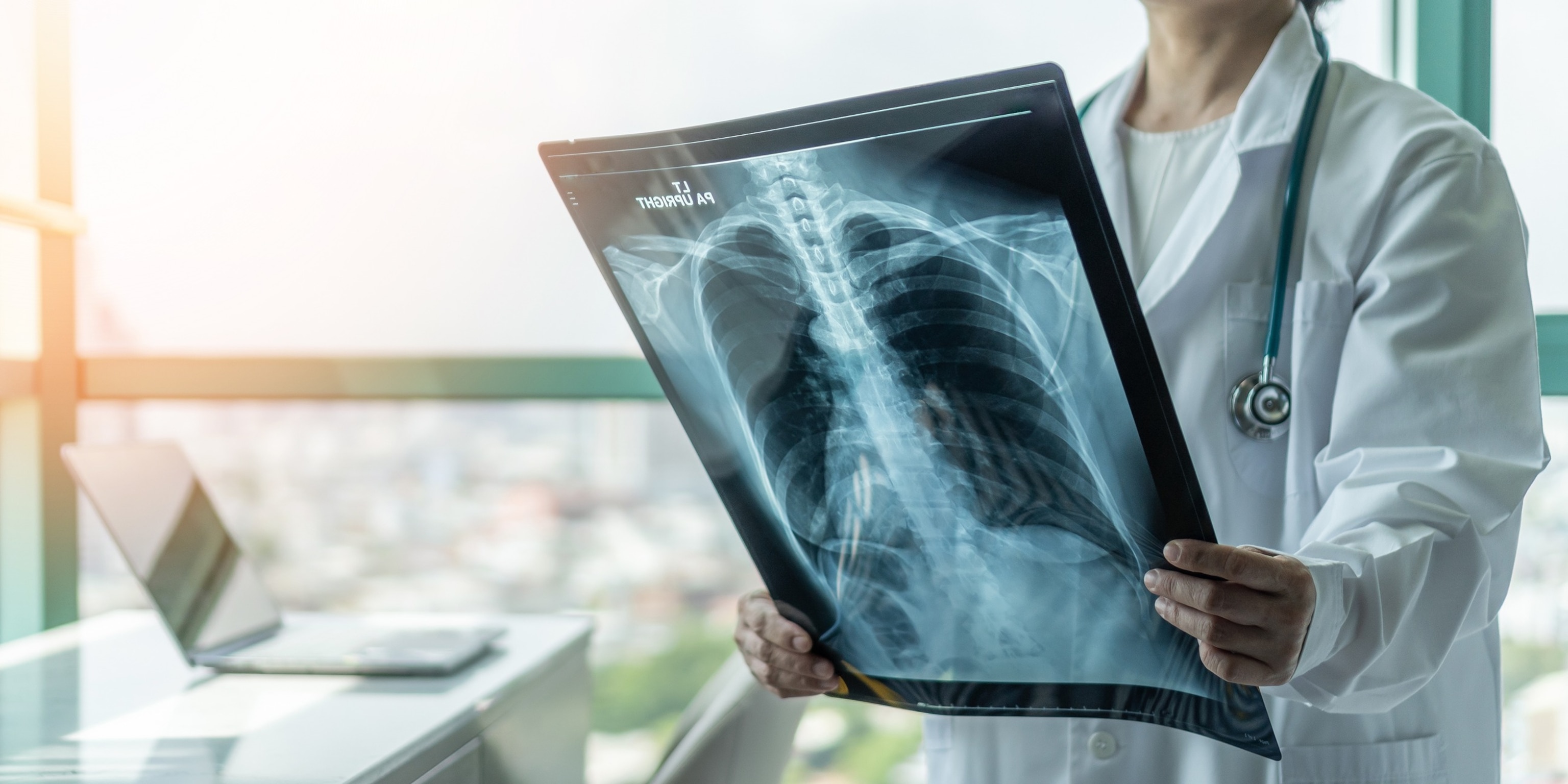 PHOTO: A doctor looks at a lung x-ray in an undated stock photo. 