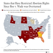 Abortion 30 Weeks