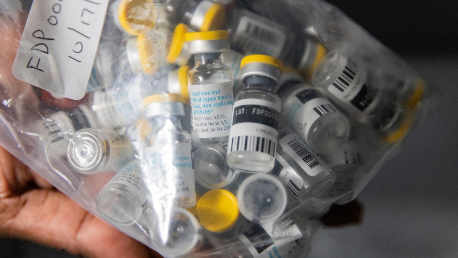 California mpox cases raise concerns. But health officials say the risk remains low