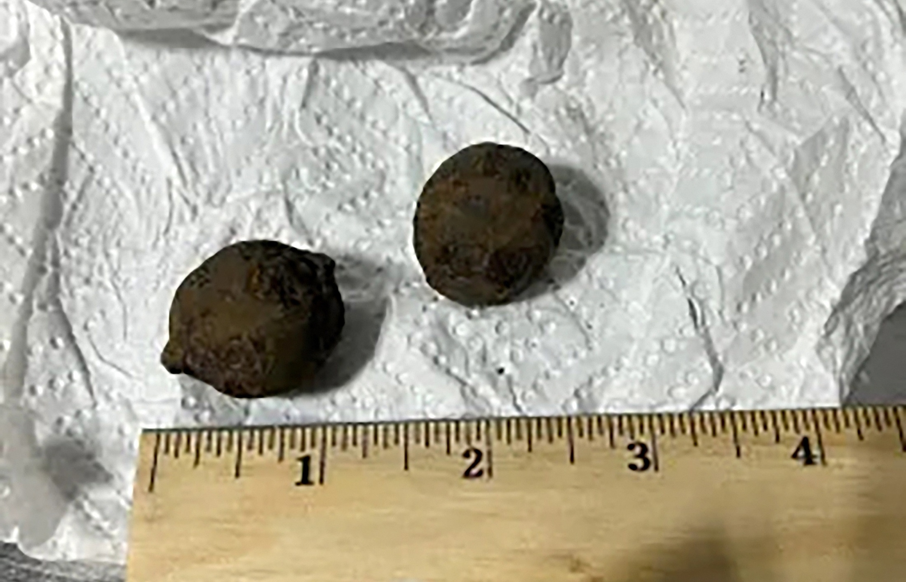 PHOTO: A TSA officer at Gulf Shores International Airport in Alabama discovered five stolen cannonballs from Fort Morgan, a historically significant site from the Civil War in a passenger bag after it triggered an alarm at a checkpoint, July 18, 2026.