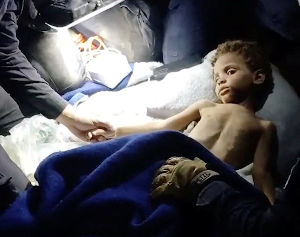 PHOTO: A child receives emergency attention after being res