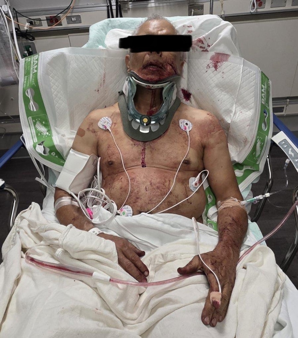 PHOTO: Indianapolis ABC affiliate WRTV obtained this photo, with the black bar in place, showing who his family says is the alleged victim in the hospital.