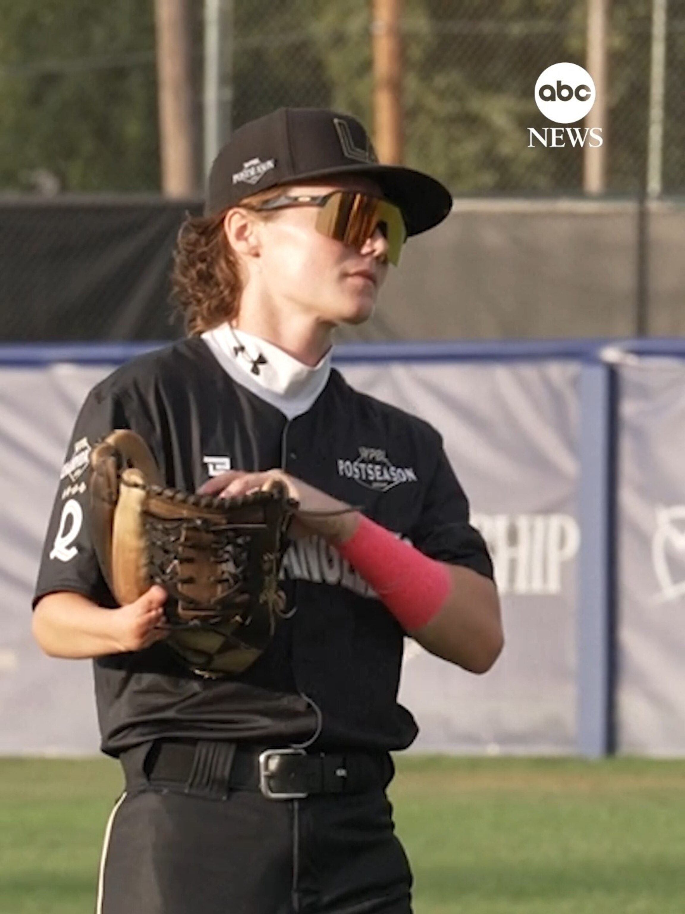 手相で病気を早期発見 ORANGE BACKS New prosthetic changes the game for baseball player born without