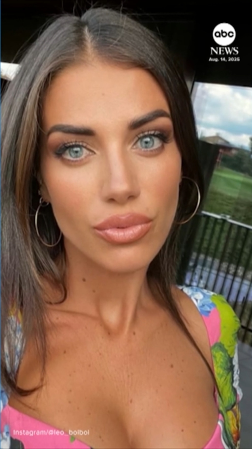 NextImg:Video Pregnant wife of former NBA player speaks out after surviving shark bite