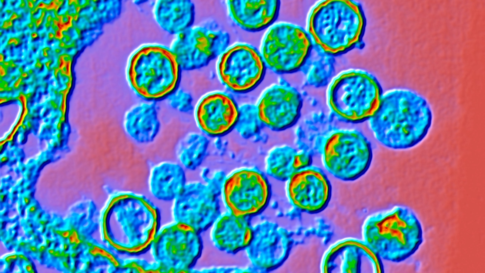 Amid a suspected hantavirus cluster, here's what to know about the disease