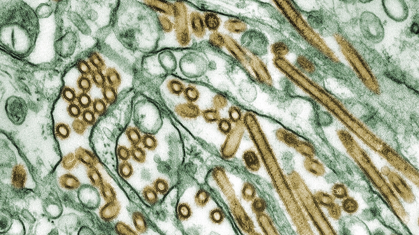 What to know about the bird flu outbreak in the US after virus ...