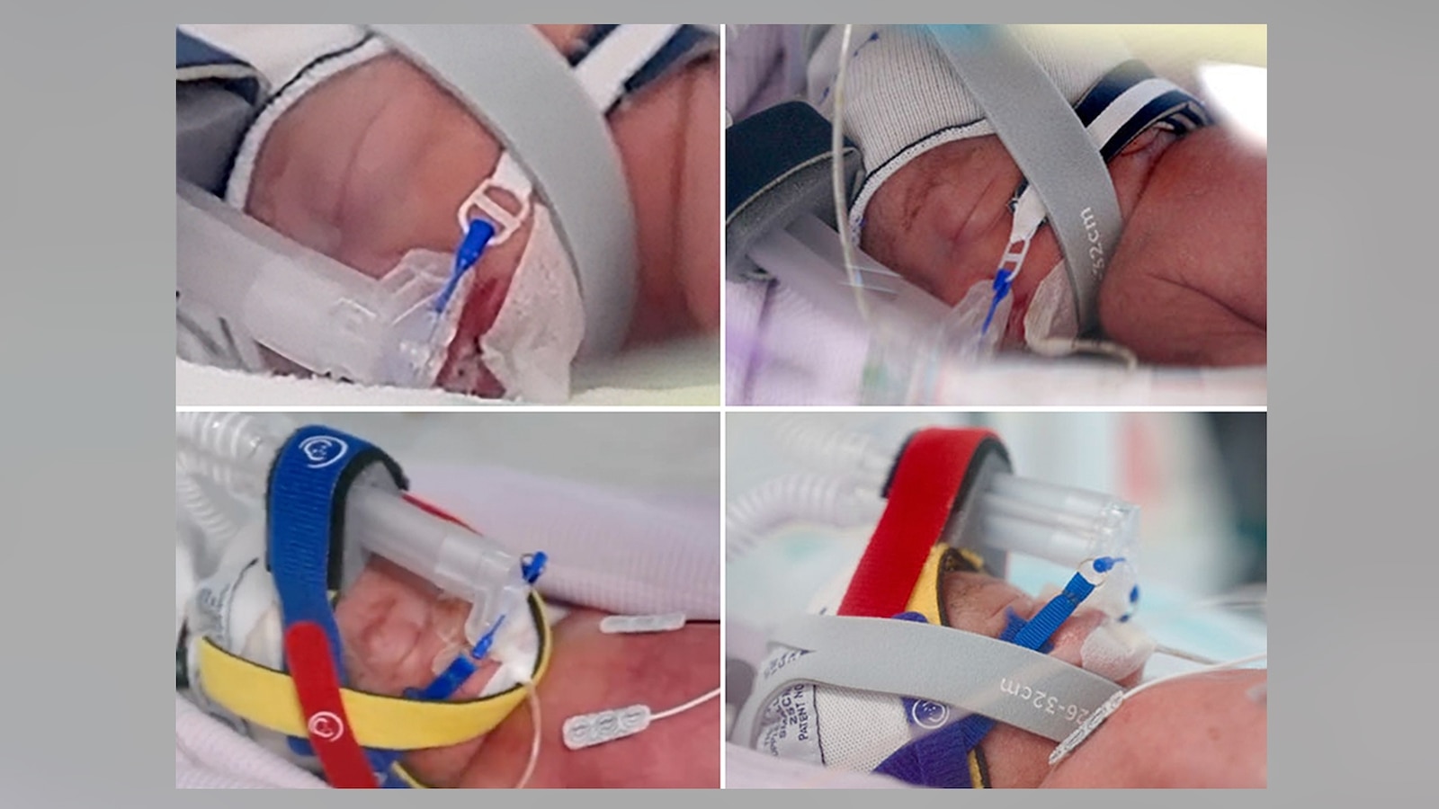 A 34-year-old woman in Australia has given birth to a rare set of identical quadruplet daughters after a pregnancy her doctor described as 
