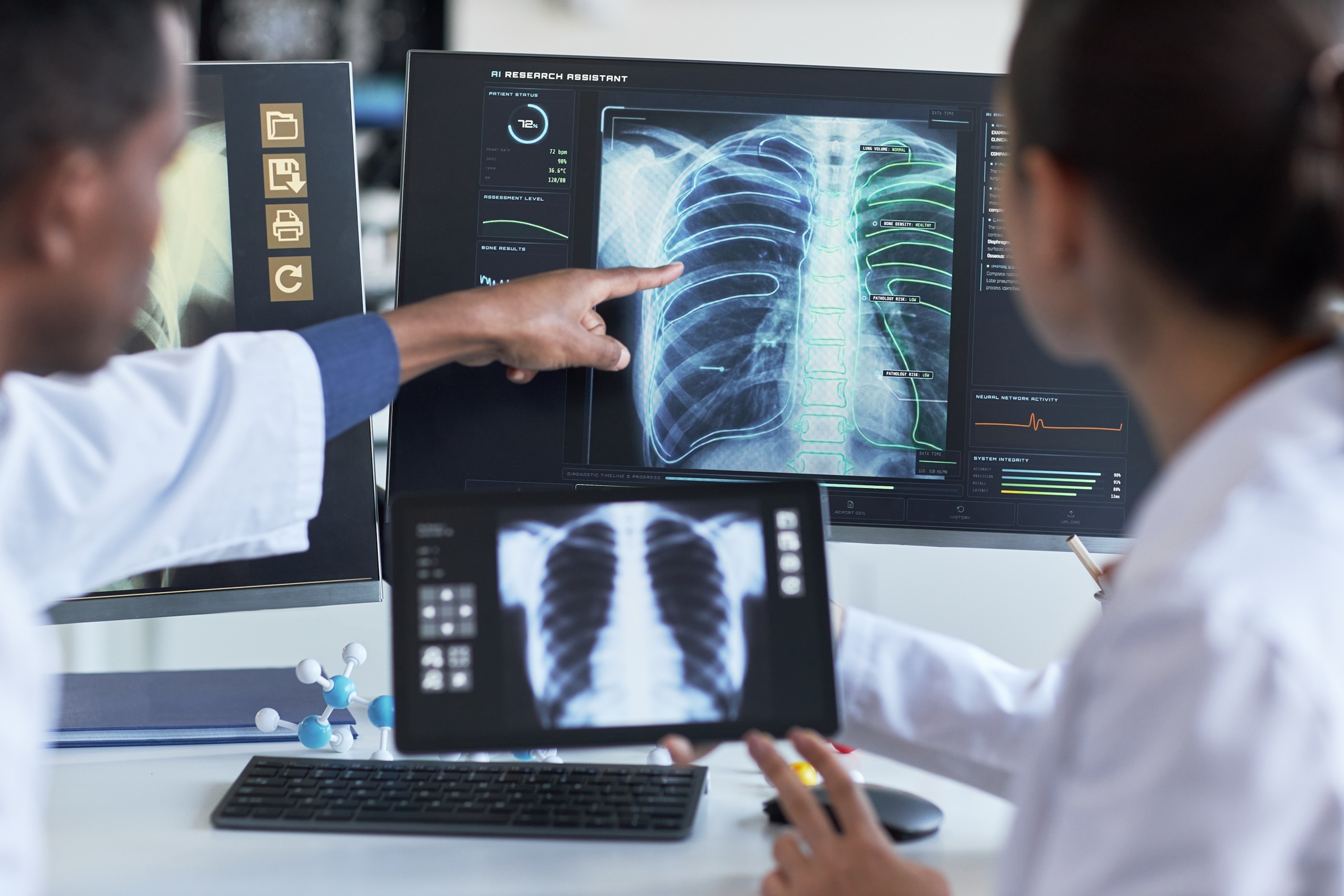 PHOTO: Doctors Reviewing Ai Assisted Chest Scan for Diagnostic Analysis
