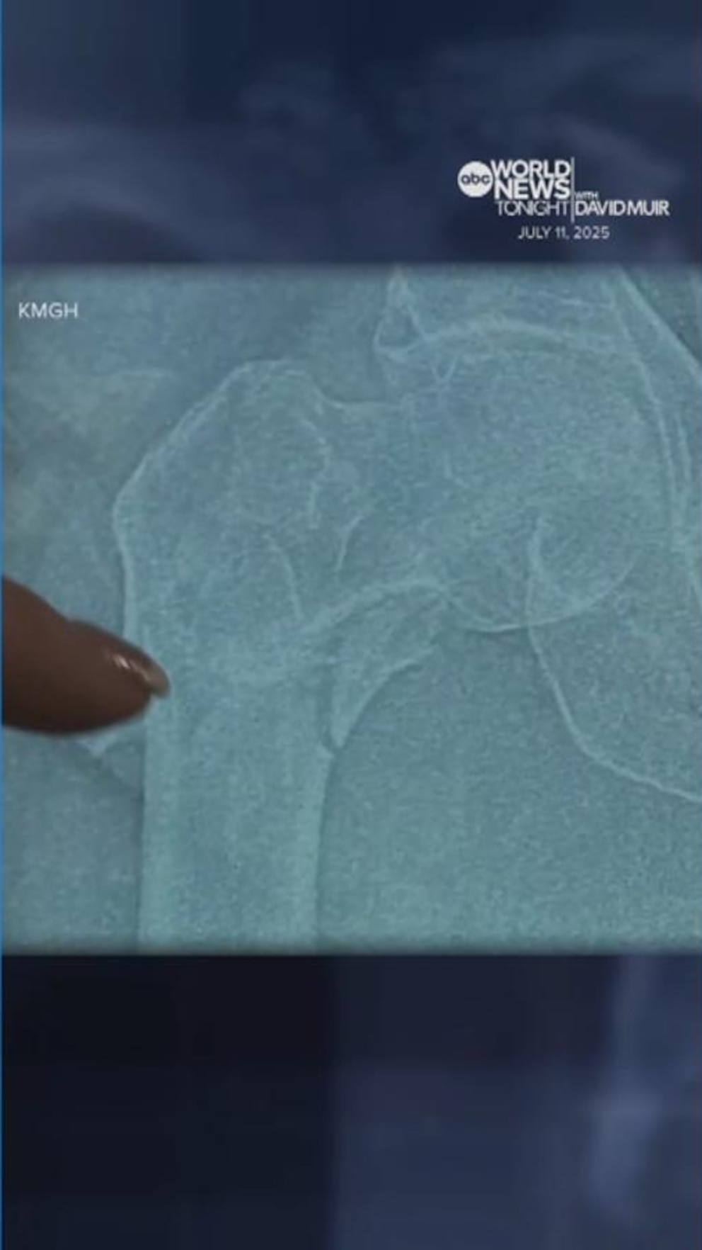 NextImg:Video Colorado grandmother crawls 14 hours to survive after injury in remote area