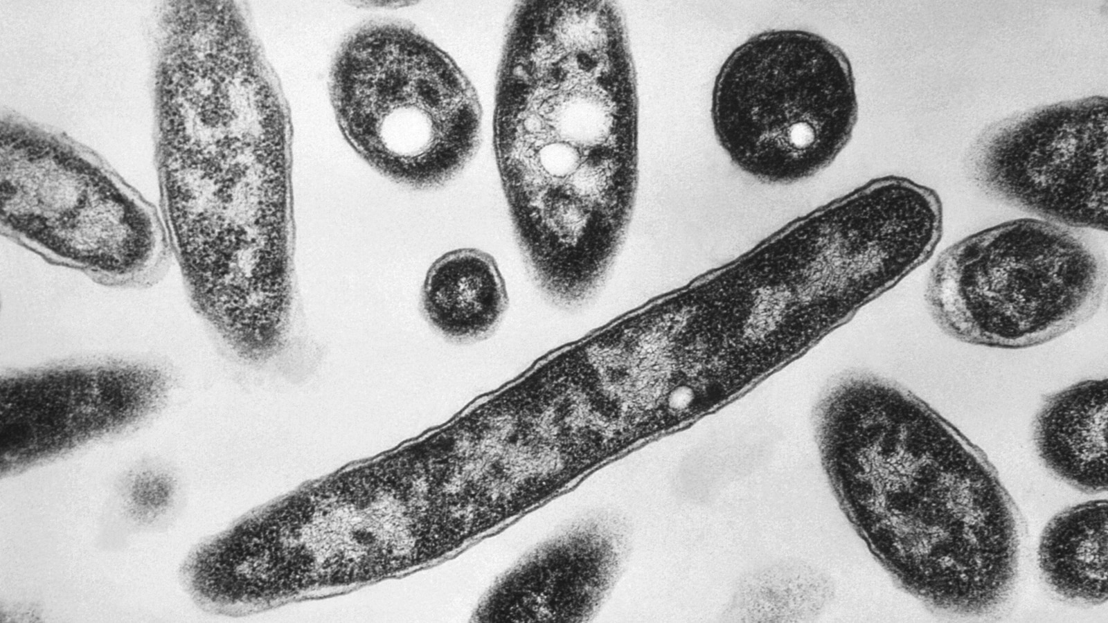 4th person dies after a Legionnaires’ disease outbreak sickens dozens in New York