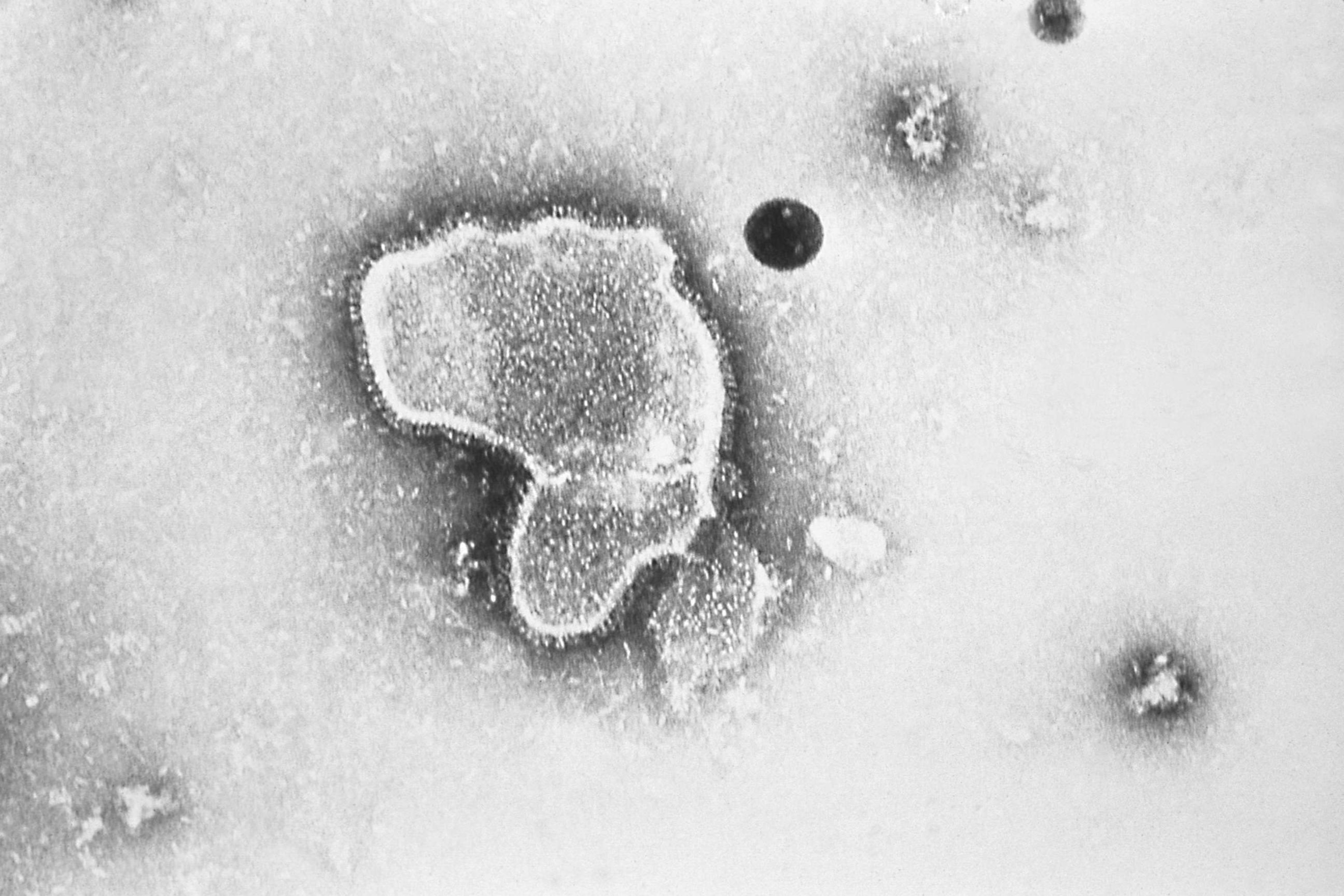 PHOTO: This 1981 photo provided by the Centers for Disease Control and Prevention (CDC) shows an electron micrograph of Respiratory Syncytial Virus, also known as RSV.