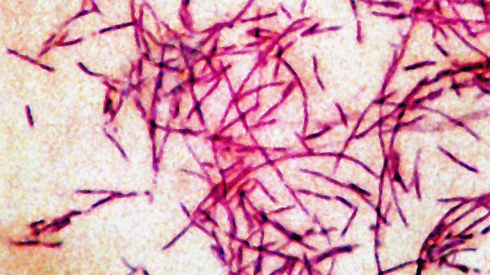 Third Death Tied to Legionnaires Cluster in NYC