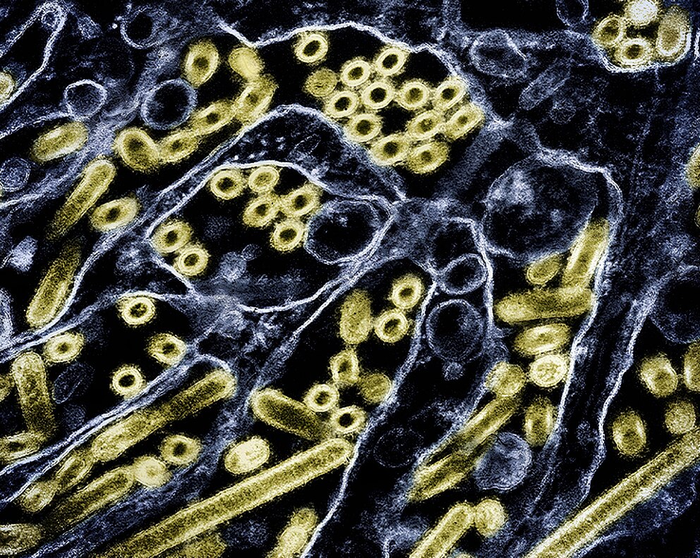 PHOTO: Avian influenza a virus