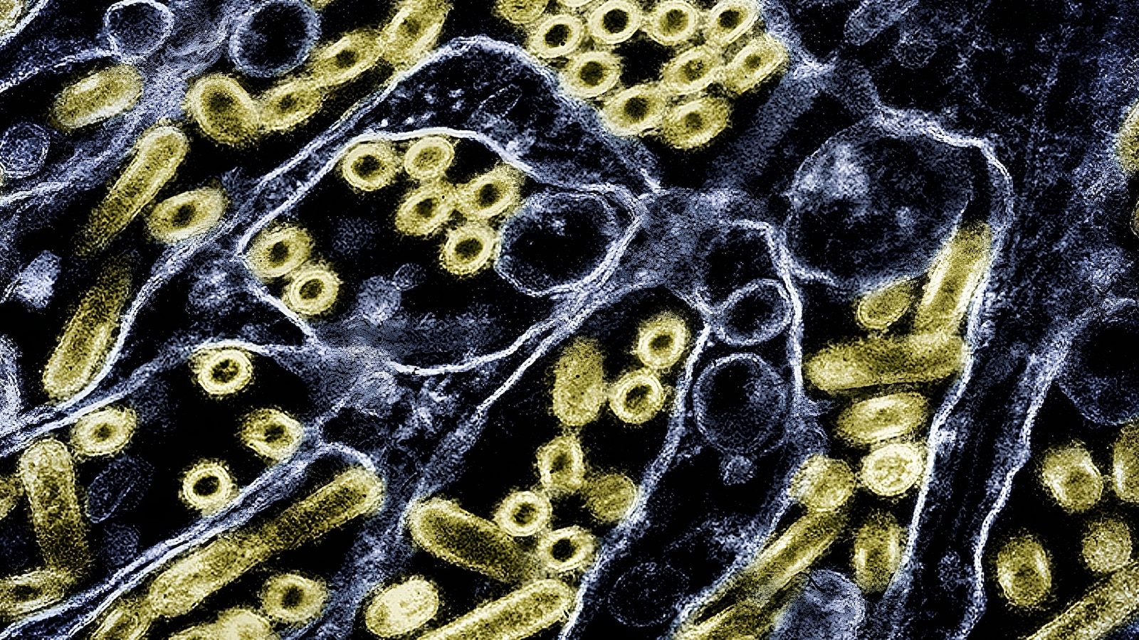 1st human known to be infected with H5N5 strain of bird flu dies, Washington state officials say