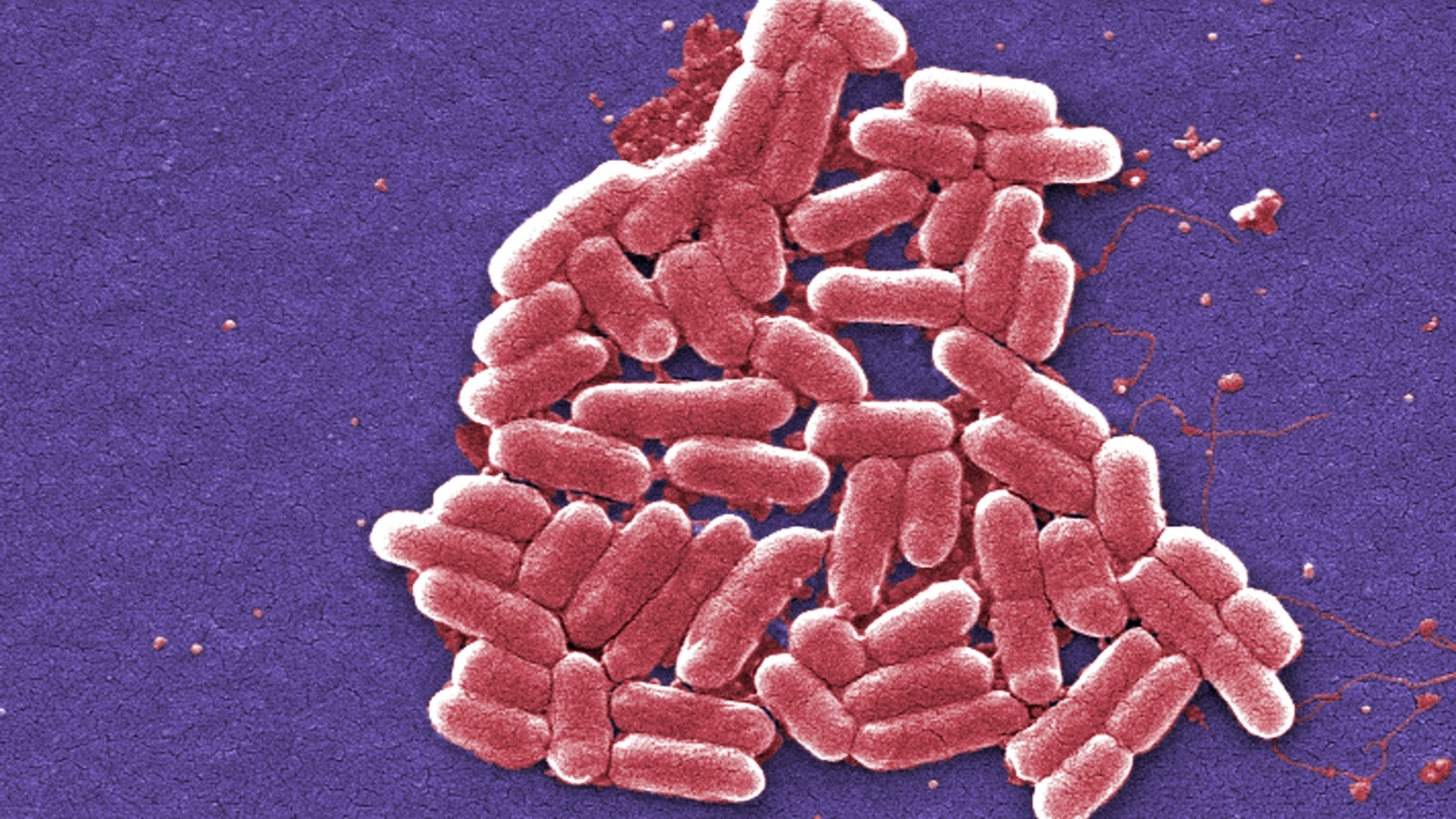  5 cases of E. coli confirmed in San Luis Obispo, possibly linked to local farm: Health officials 