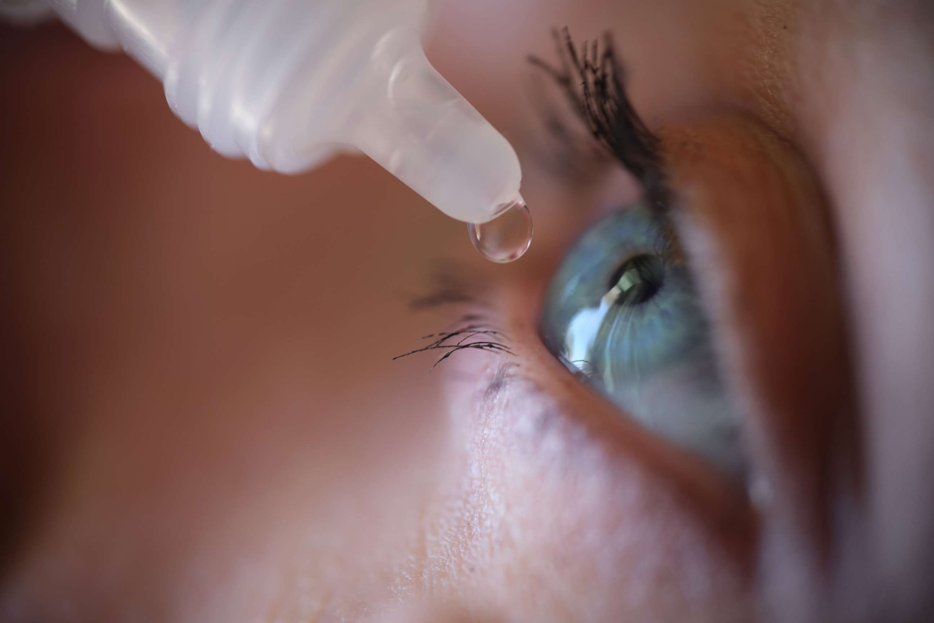 PHOTO: Stock photo of a woman applying eye drops to her eye.