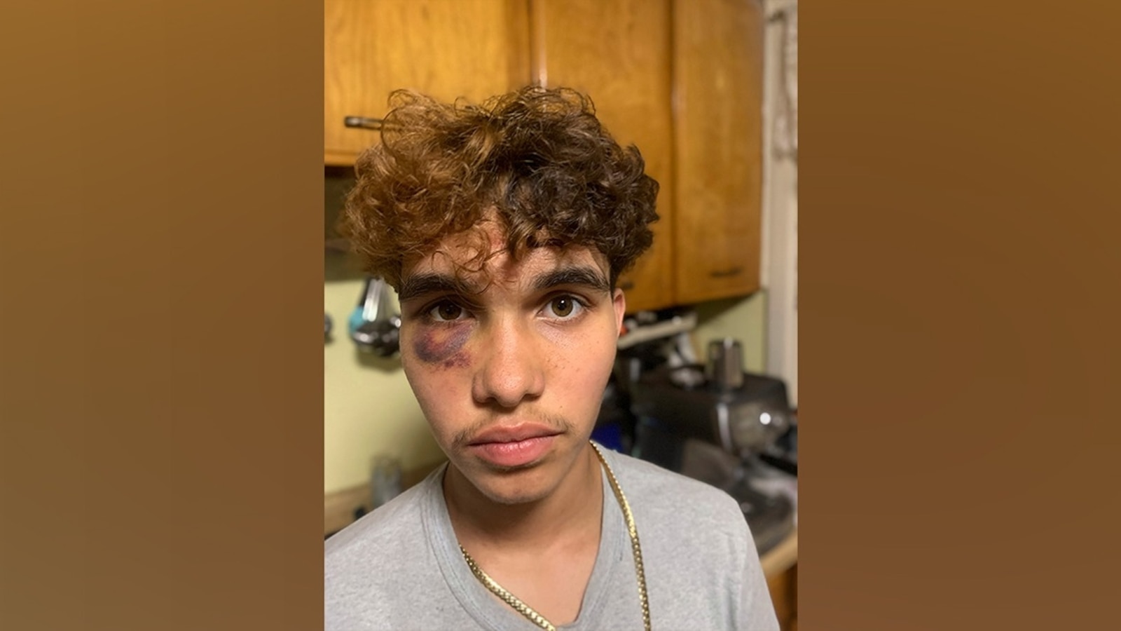 Attack on trans teen being investigated as 'possible hate crime' - ABC News